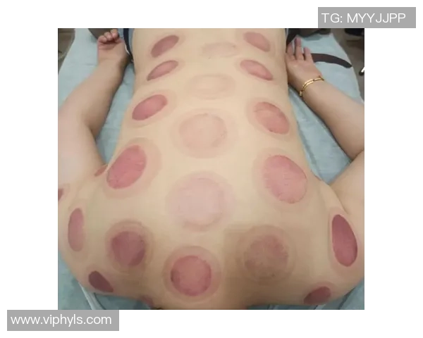 足球明星热衷拔罐疗法揭秘运动员如何通过传统疗法提升竞技状态